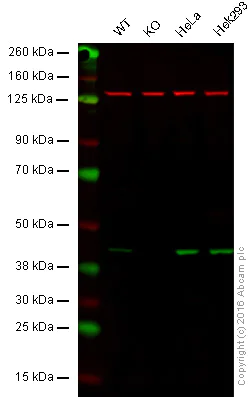Western blot - Anti-CAMK1D antibody [EPR3536(2)] - BSA and Azide free (AB249712)