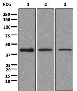 Western blot - Anti-CAMK1D antibody [EPR3536(2)] - BSA and Azide free (AB249712)