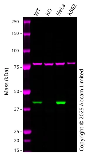 Western blot - Anti-CAMK1D antibody [EPR3536(2)] - BSA and Azide free (AB249712)