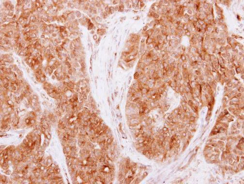 Immunohistochemistry (Formalin/PFA-fixed paraffin-embedded sections) - Anti-CAMK1G antibody (AB227209)
