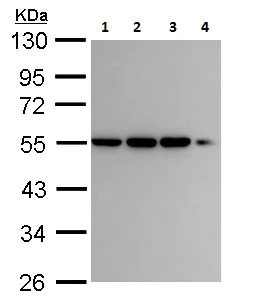 Western blot - Anti-CAMK1G antibody (AB227209)