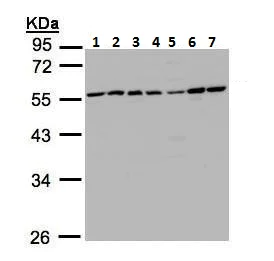 Western blot - Anti-CAMK1G antibody (AB227209)