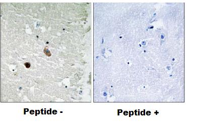 Immunohistochemistry (Formalin/PFA-fixed paraffin-embedded sections) - Anti-CaMK2 beta gamma delta antibody (AB79359)
