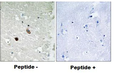 Immunohistochemistry (Formalin/PFA-fixed paraffin-embedded sections) - Anti-CaMK2 beta gamma delta antibody (AB79359)