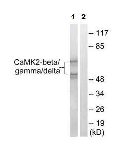 Western blot - Anti-CaMK2 beta gamma delta antibody (AB79359)