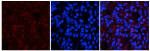 Immunocytochemistry/ Immunofluorescence - Anti-CaMK2 beta gamma delta (phospho T287) antibody (AB182647)