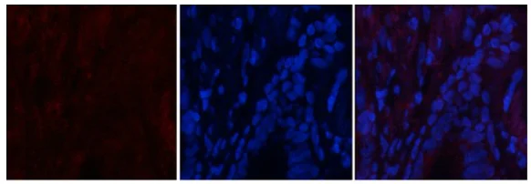 Immunocytochemistry/ Immunofluorescence - Anti-CaMK2 beta gamma delta (phospho T287) antibody (AB182647)