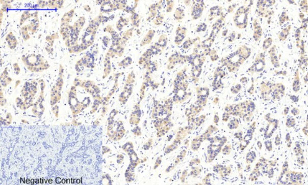 Immunohistochemistry (Formalin/PFA-fixed paraffin-embedded sections) - Anti-CaMK2 beta gamma delta (phospho T287) antibody (AB182647)