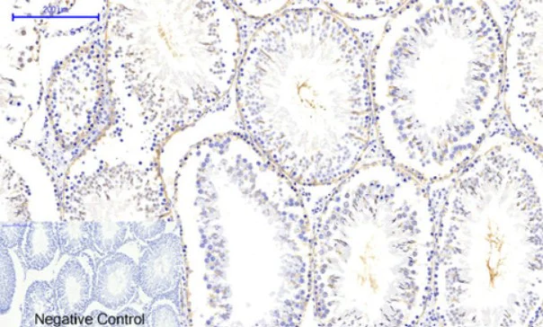 Immunohistochemistry (Formalin/PFA-fixed paraffin-embedded sections) - Anti-CaMK2 beta gamma delta (phospho T287) antibody (AB182647)