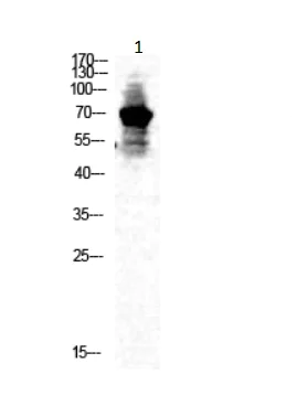 Western blot - Anti-CaMK2 beta gamma delta (phospho T287) antibody (AB182647)