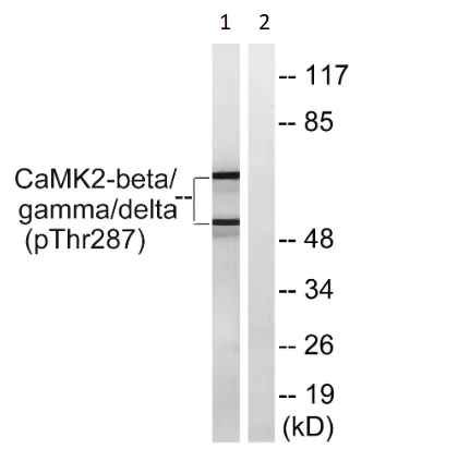 Western blot - Anti-CaMK2 beta gamma delta (phospho T287) antibody (AB182647)