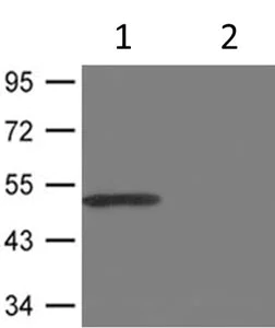 Western blot - Anti-CaMK2 beta gamma delta (phospho T287) antibody (AB182647)