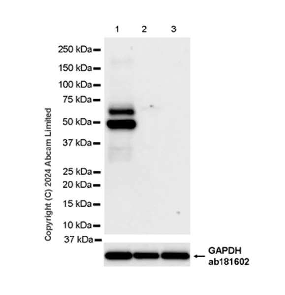 Western blot - Anti-CAMK2B/2D/2G (phospho T287) + CAMK2A (phospho T286) antibody [EPR28075-37] (AB320638)