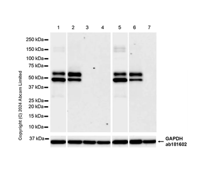 Western blot - Anti-CAMK2B/2D/2G (phospho T287) + CAMK2A (phospho T286) antibody [EPR28075-37] (AB320638)