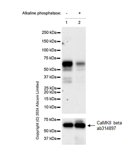 Western blot - Anti-CAMK2B/2D/2G (phospho T287) + CAMK2A (phospho T286) antibody [EPR28075-37] - BSA and Azide free (ab320639), expandable thumbnail