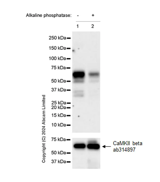 Western blot - Anti-CAMK2B/2D/2G (phospho T287) + CAMK2A (phospho T286) antibody [EPR28075-37] - BSA and Azide free (AB320639)