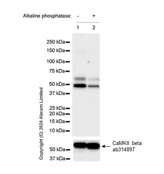 Western blot - Anti-CAMK2B/2D/2G (phospho T287) + CAMK2A (phospho T286) antibody [EPR28075-37] - BSA and Azide free (AB320639), expandable thumbnail