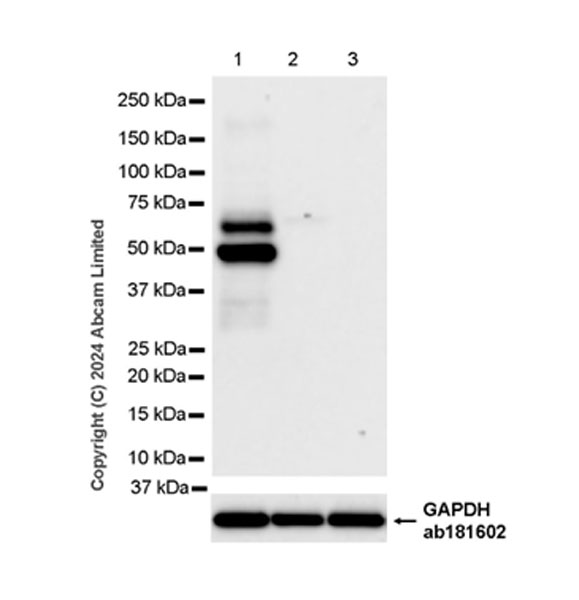 Western blot - Anti-CAMK2B/2D/2G (phospho T287) + CAMK2A (phospho T286) antibody [EPR28075-37] - BSA and Azide free (AB320639), expandable thumbnail