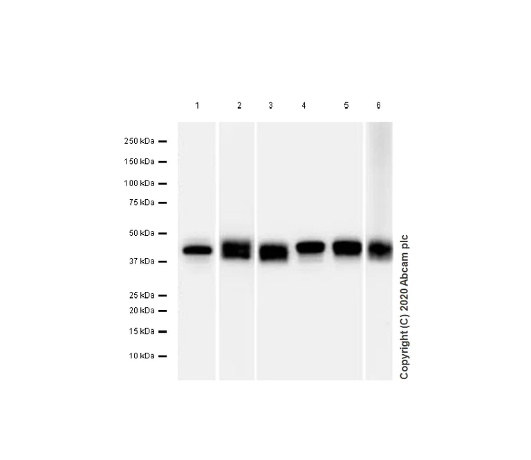 Western blot - Anti-CaMKI antibody [EPR2217Y] (AB68234)