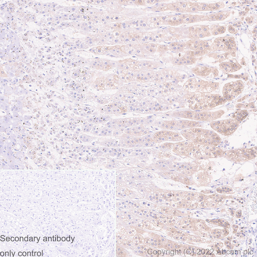Immunohistochemistry (Formalin/PFA-fixed paraffin-embedded sections) - Anti-CaMKI antibody [EPR2217Y] - BSA and Azide free (AB239859), expandable thumbnail