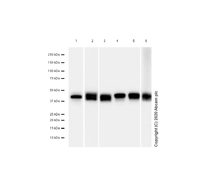 Western blot - Anti-CaMKI antibody [EPR2217Y] - BSA and Azide free (AB239859), expandable thumbnail