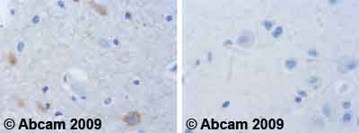 Immunohistochemistry (Formalin/PFA-fixed paraffin-embedded sections) - Anti-CaMKI (phospho T177) antibody (AB62215)