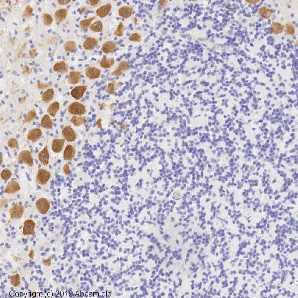 Immunohistochemistry (Formalin/PFA-fixed paraffin-embedded sections) - Anti-CaMKII alpha antibody [6G9] (AB22609)