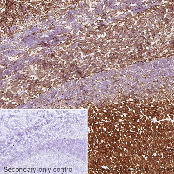 Immunohistochemistry (Frozen sections) - Anti-CaMKII alpha antibody [6G9] (AB22609)