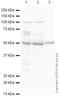 Western blot - Anti-CaMKII alpha antibody [6G9] (AB22609)