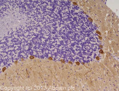 Immunohistochemistry (Formalin/PFA-fixed paraffin-embedded sections) - Anti-CaMKII alpha antibody (AB103840)
