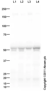 Western blot - Anti-CaMKII alpha antibody (AB103840)