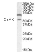 Western blot - Anti-CaMKII alpha antibody (AB87597)