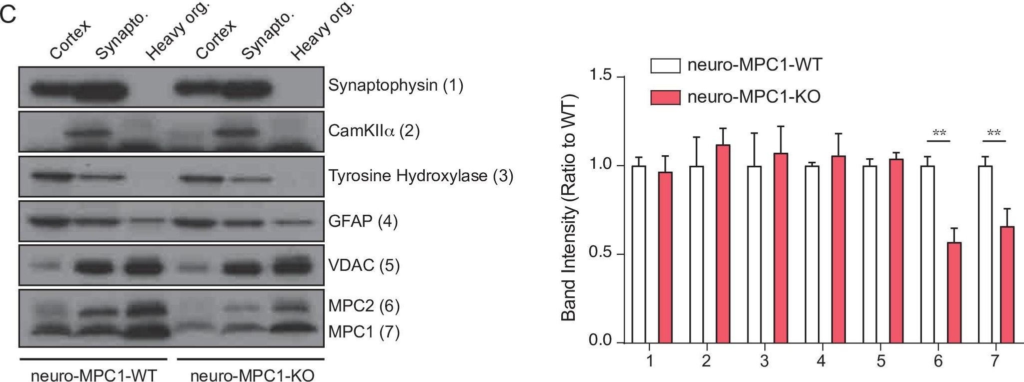 Western blot - Anti-CaMKII alpha antibody (AB87597)