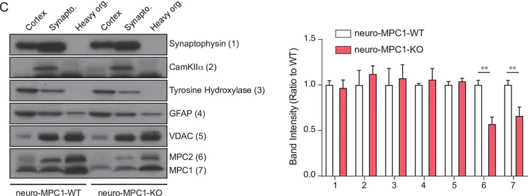 Western blot - Anti-CaMKII alpha antibody (AB87597)