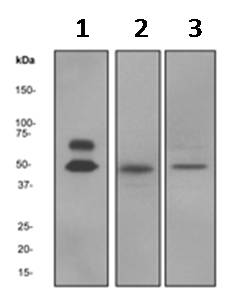 Western blot - Anti-CaMKII alpha antibody [EPR1828] (AB92332), expandable thumbnail