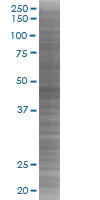 SDS-PAGE - CaMKII alpha overexpression 293T lysate (whole cell) (AB94251)