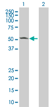 Western blot - CaMKII alpha overexpression 293T lysate (whole cell) (AB94251)