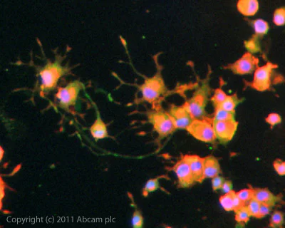 Immunocytochemistry/ Immunofluorescence - Anti-CaMKII alpha (phospho T286) antibody (AB5683)