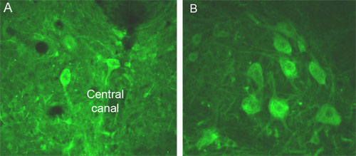 Immunohistochemistry (PFA perfusion fixed frozen sections) - Anti-CaMKII alpha (phospho T286) antibody (AB5683)