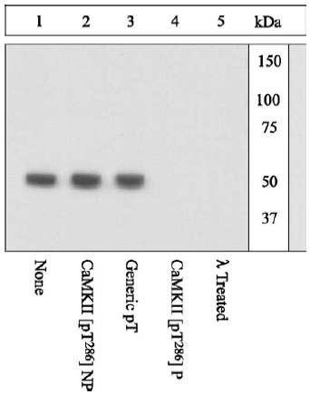 Western blot - Anti-CaMKII alpha (phospho T286) antibody (AB5683)