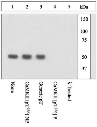 Western blot - Anti-CaMKII alpha (phospho T286) antibody (AB5683)