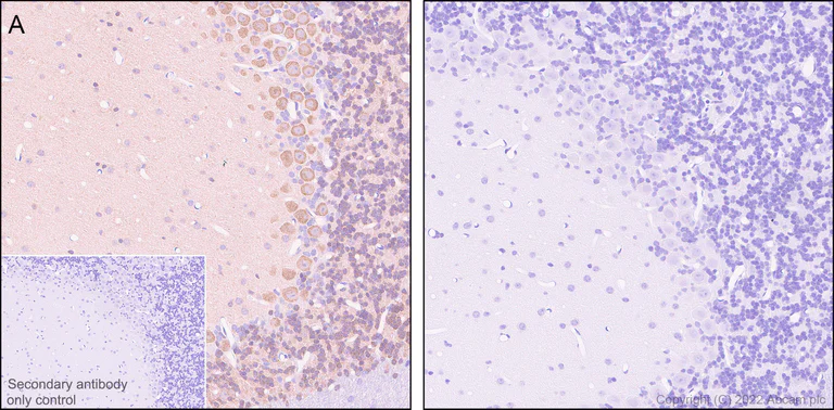Immunohistochemistry (Formalin/PFA-fixed paraffin-embedded sections) - Anti-CaMKII alpha (phospho T286) antibody [EPR1830] (AB124880)