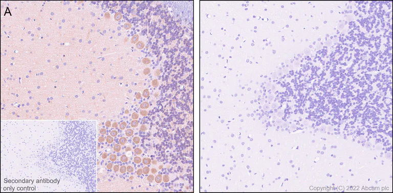 Immunohistochemistry (Formalin/PFA-fixed paraffin-embedded sections) - Anti-CaMKII alpha (phospho T286) antibody [EPR1830] (AB124880)