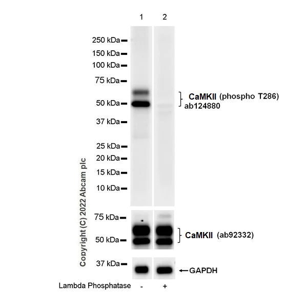 Western blot - Anti-CaMKII alpha (phospho T286) antibody [EPR1830] - BSA and Azide free (AB248035)
