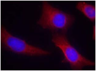 Immunocytochemistry/ Immunofluorescence - Anti-CaMKII antibody (AB131468)