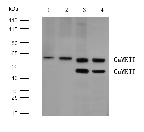 Western blot - Anti-CaMKII antibody (AB131468)