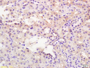 Immunohistochemistry (Formalin/PFA-fixed paraffin-embedded sections) - Anti-CaMKII antibody (AB216503)