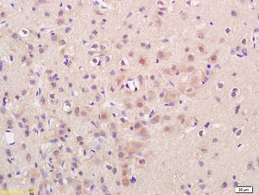 Immunohistochemistry (Formalin/PFA-fixed paraffin-embedded sections) - Anti-CaMKII antibody (AB216503)