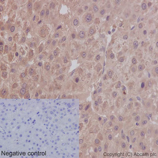 Immunohistochemistry (Formalin/PFA-fixed paraffin-embedded sections) - Anti-CaMKII antibody [EP1829Y] (AB52476)