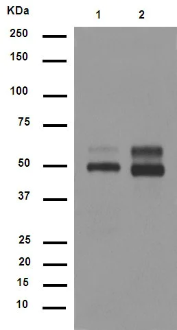 Western blot - Anti-CaMKII antibody [EP1829Y] (AB52476)